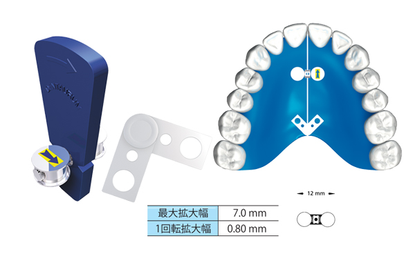 ファンタイプスクリュー