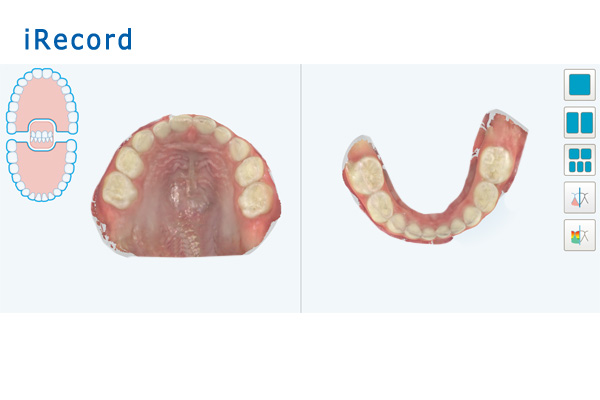 iRecord