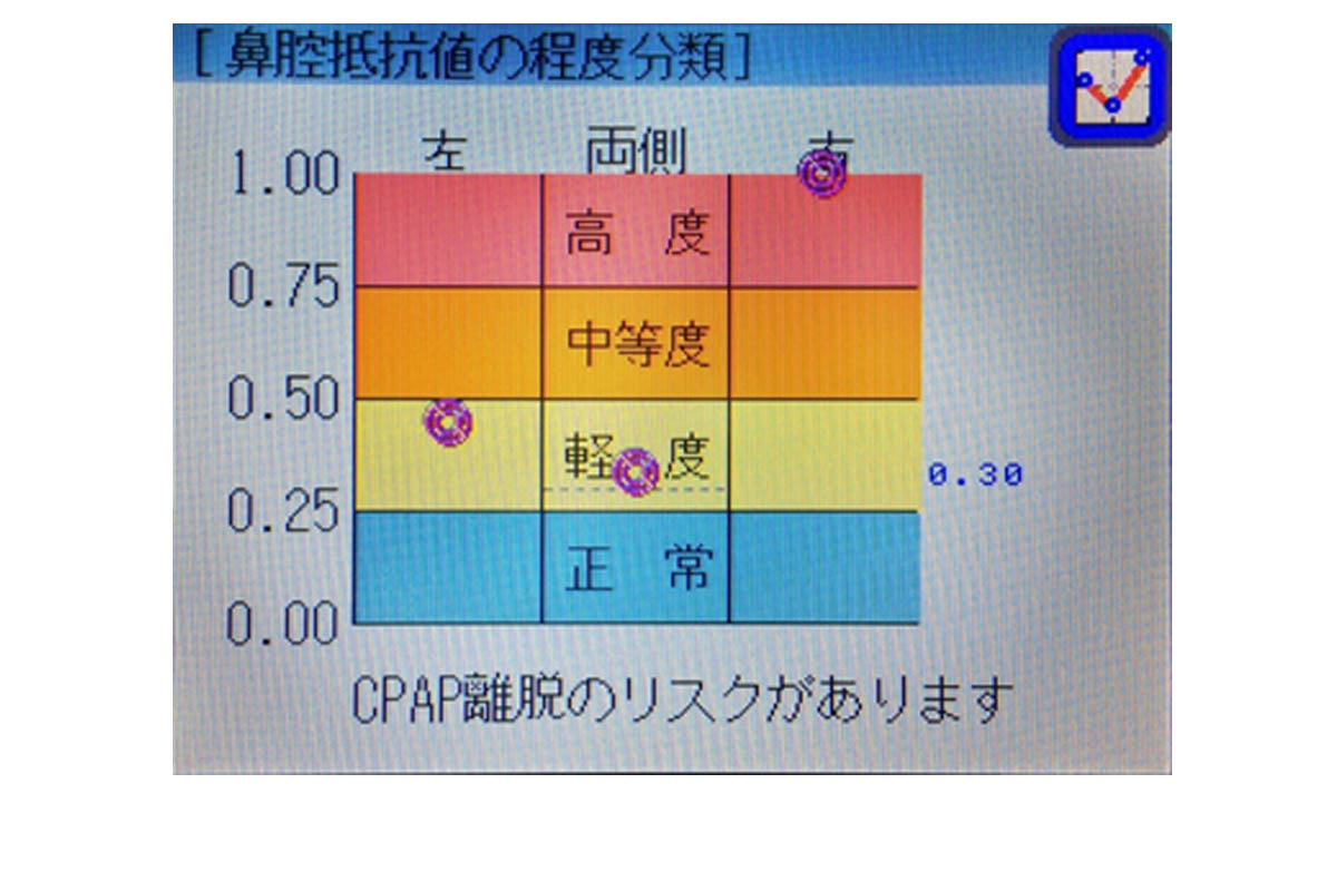 本体画面表示例（検査結果）