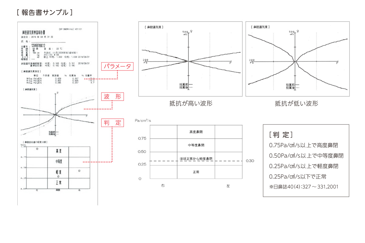 検査結果サンプル（記録紙）